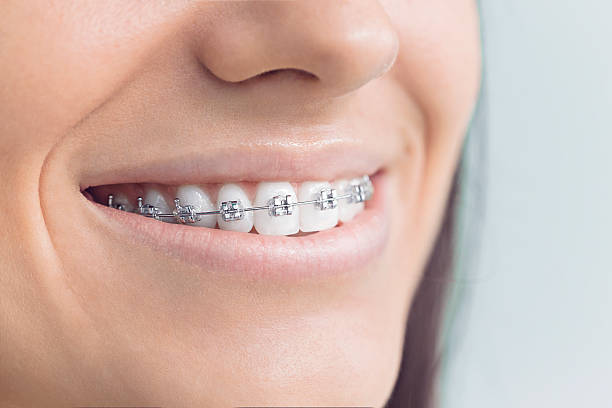 Best Full Mouth Reconstruction  in Plafield, IN